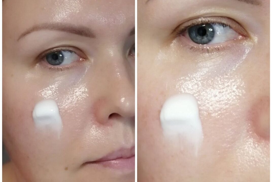 Application of Inno Gialuron cream