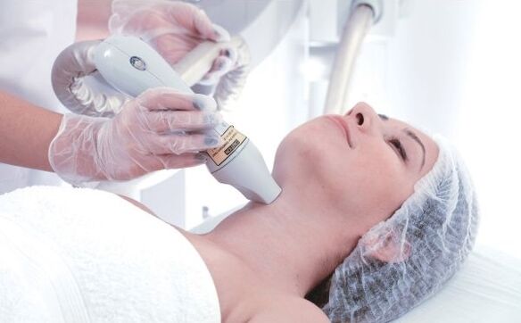 fractional skin resurfacing with laser