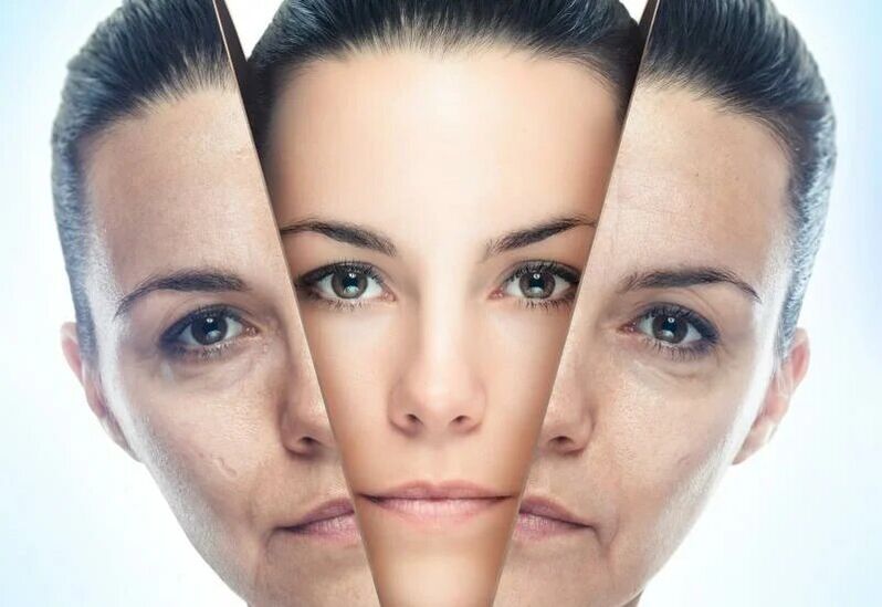 Care correct of your skin